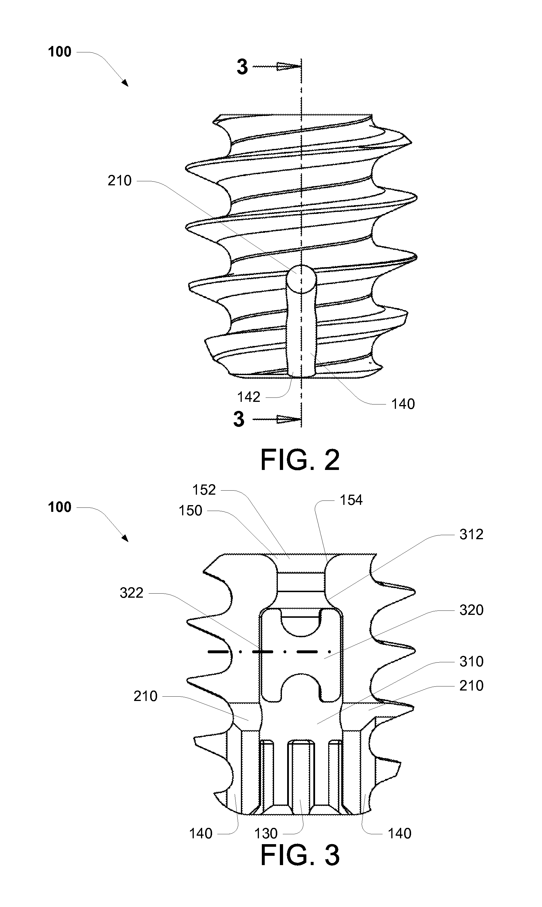 Swivel Screw Ligament Fixation Device