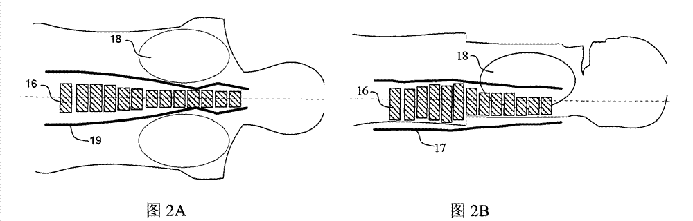 X-ray computerized tomography system and method