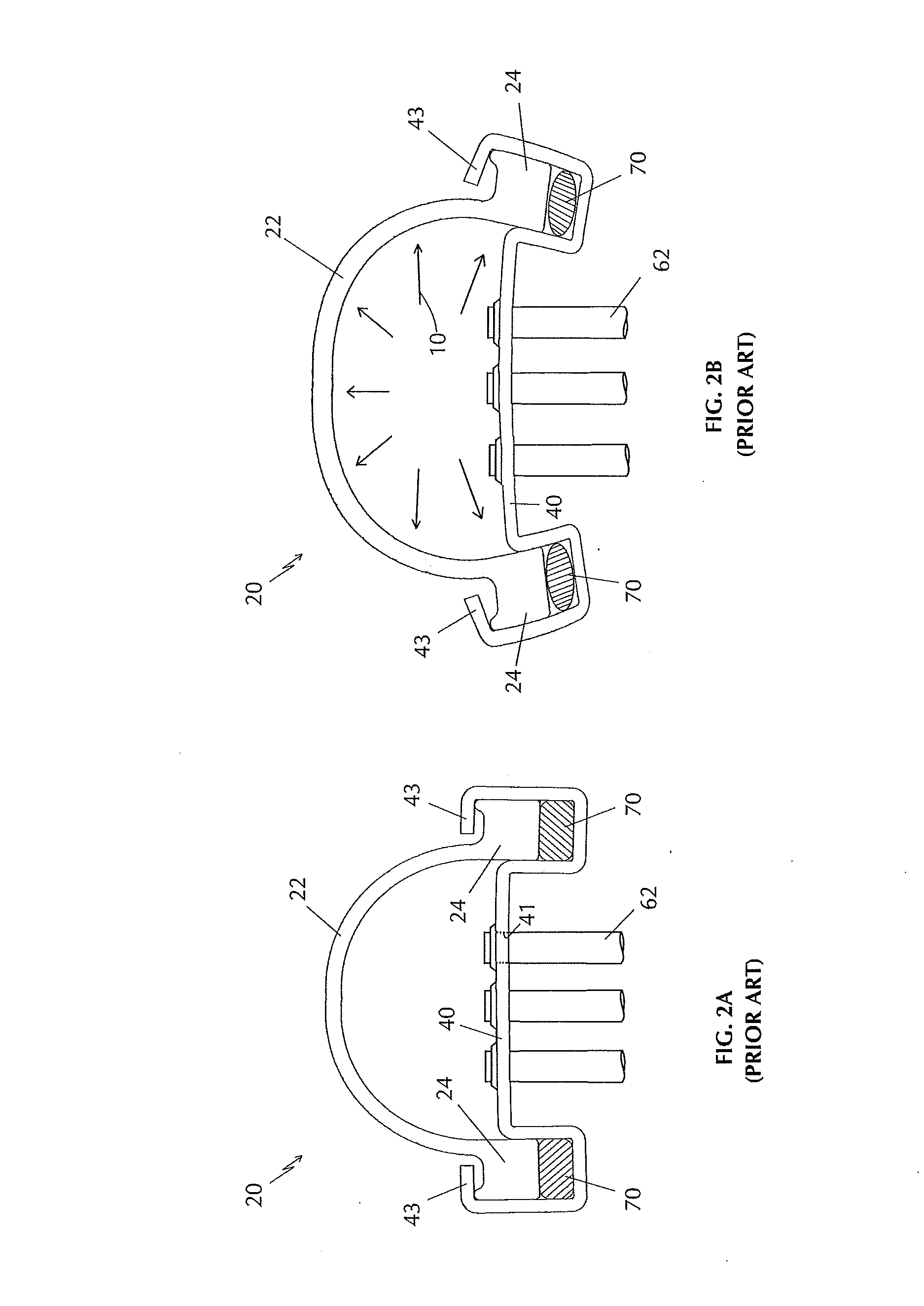 Radiator tank fastening system