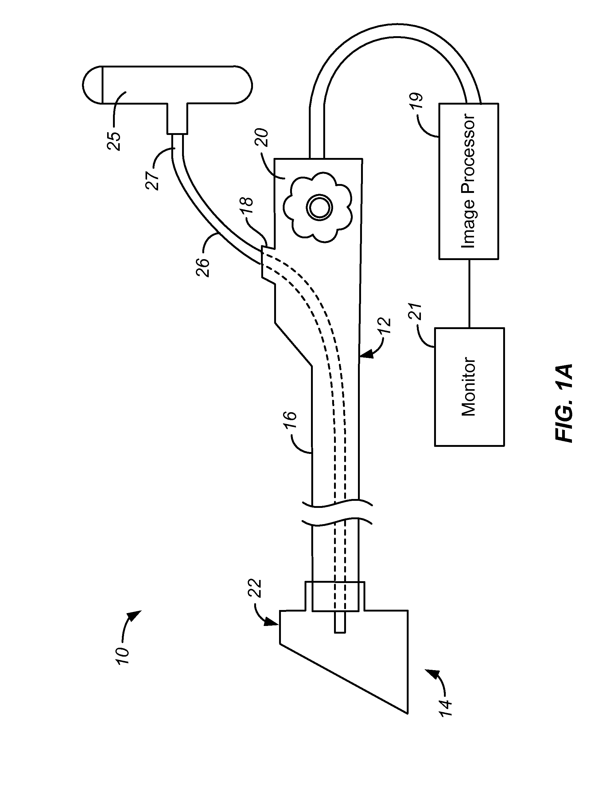 Focal Ablation Assembly