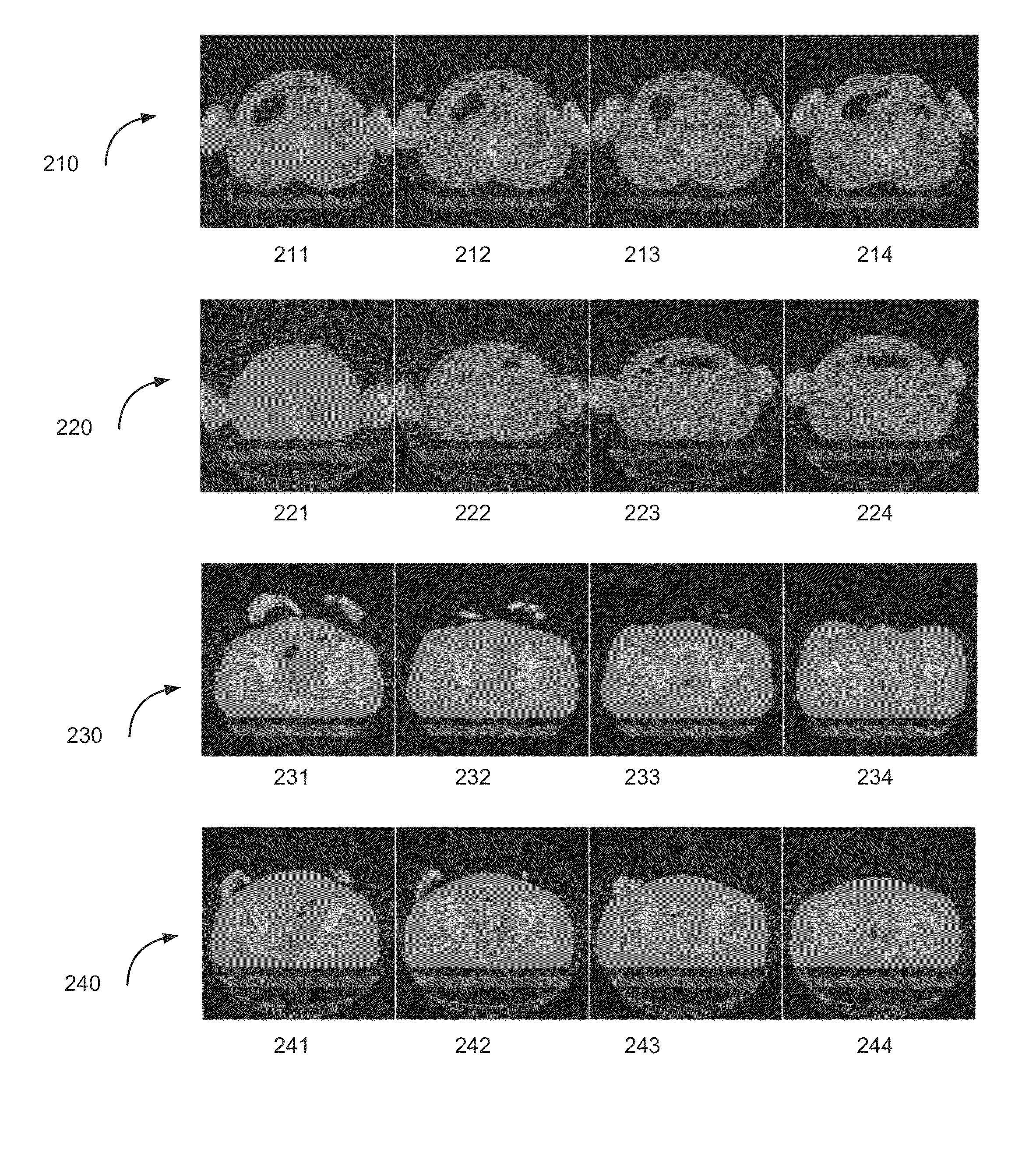 Image reconstruction in computed tomography