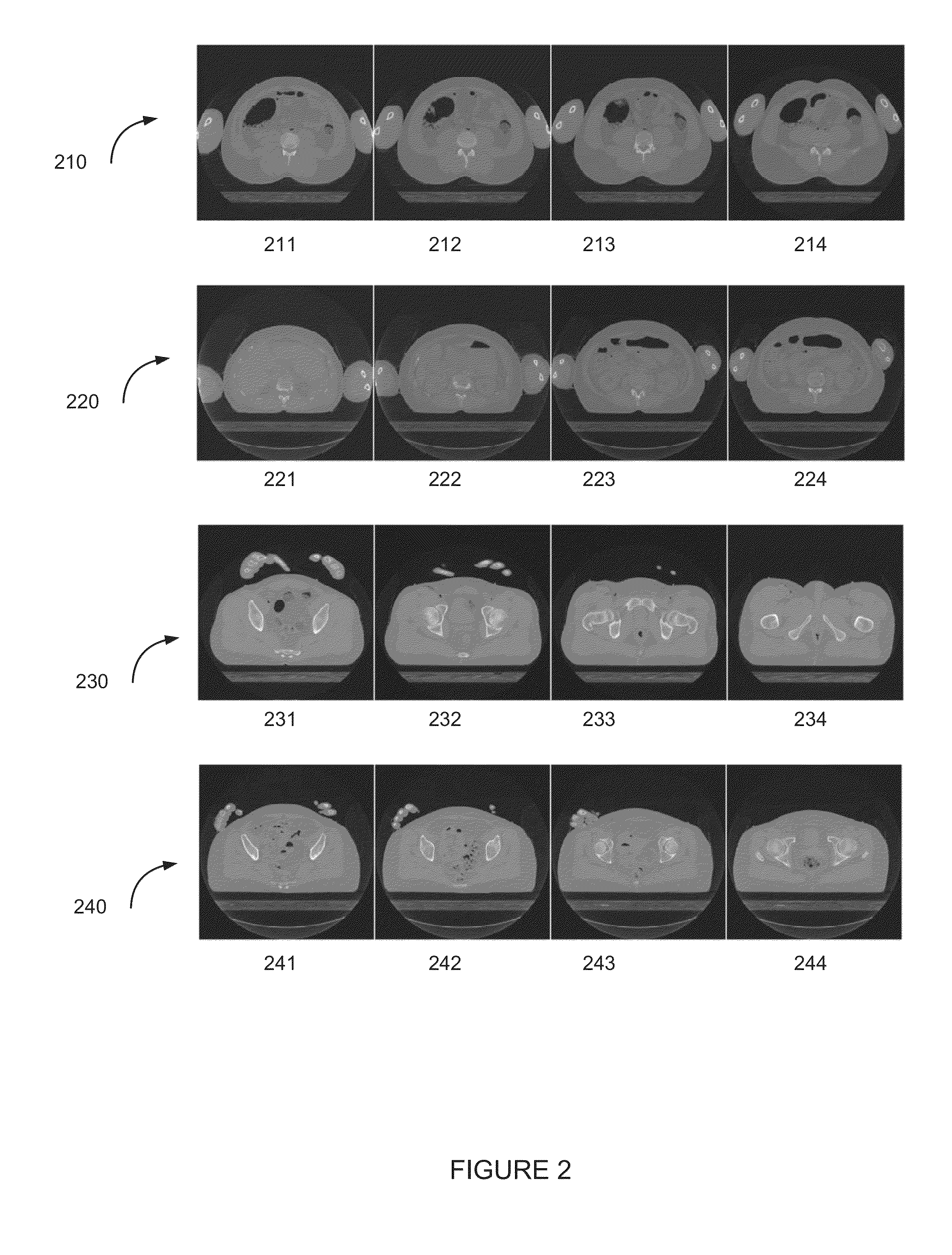 Image reconstruction in computed tomography