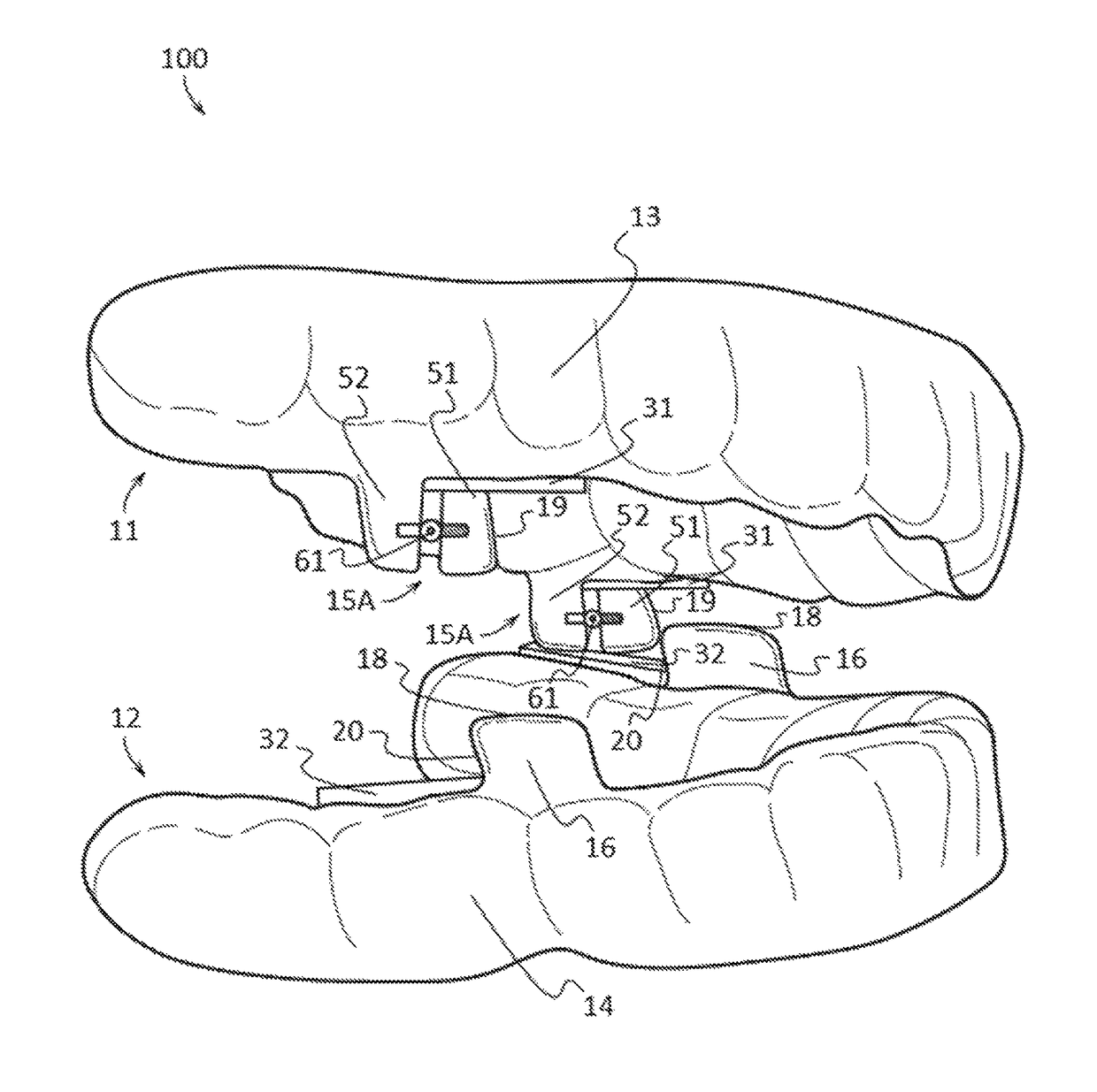 Oral apparatuses and methods for mandibular jaw manipulation