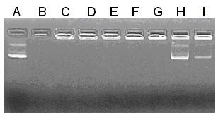 Chitosan-DNA nanometer granule complex and preparation method thereof