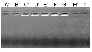 Chitosan-DNA nanometer granule complex and preparation method thereof