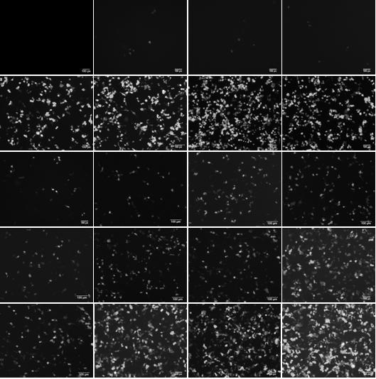 Chitosan-DNA nanometer granule complex and preparation method thereof