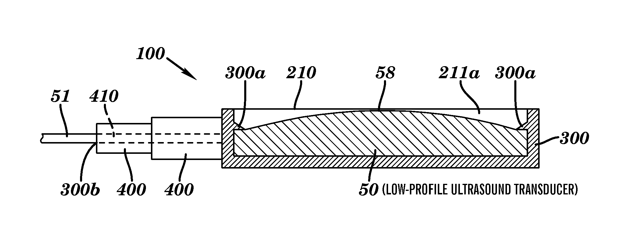 Ultrasound coupling device