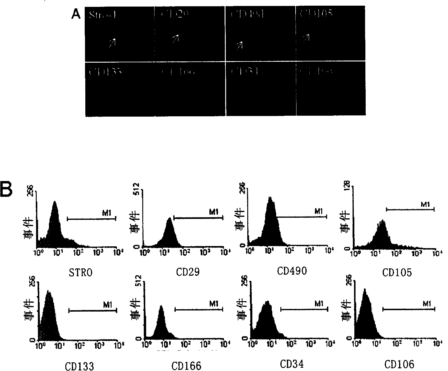 Culture and use for dermis fibroblast