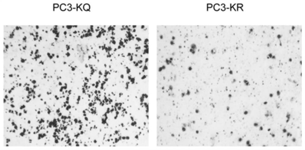 Screening method of medicament for preventing prostatic cancer and application of nitazoxanide in pharmacy