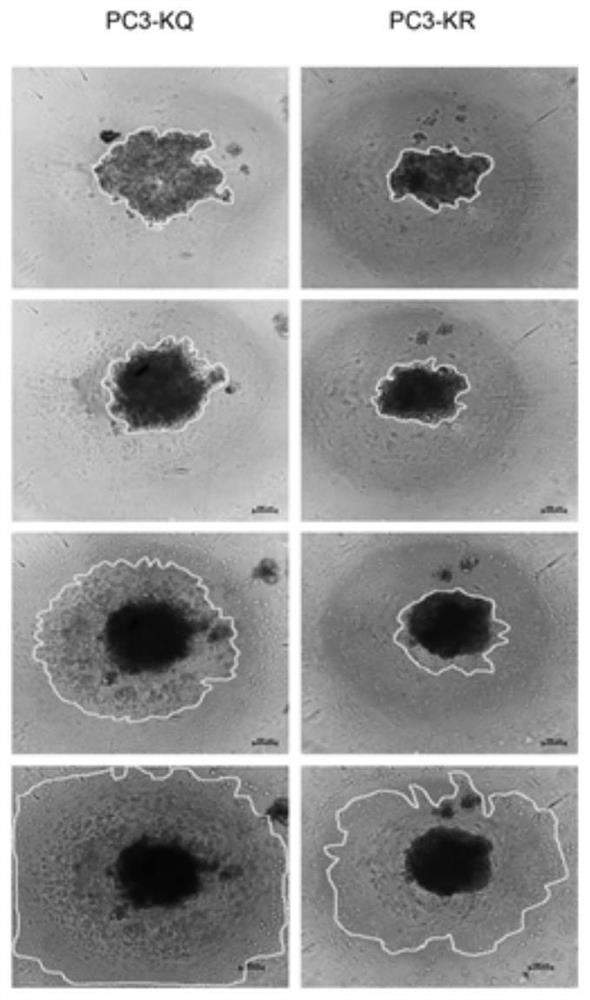 Screening method of medicament for preventing prostatic cancer and application of nitazoxanide in pharmacy