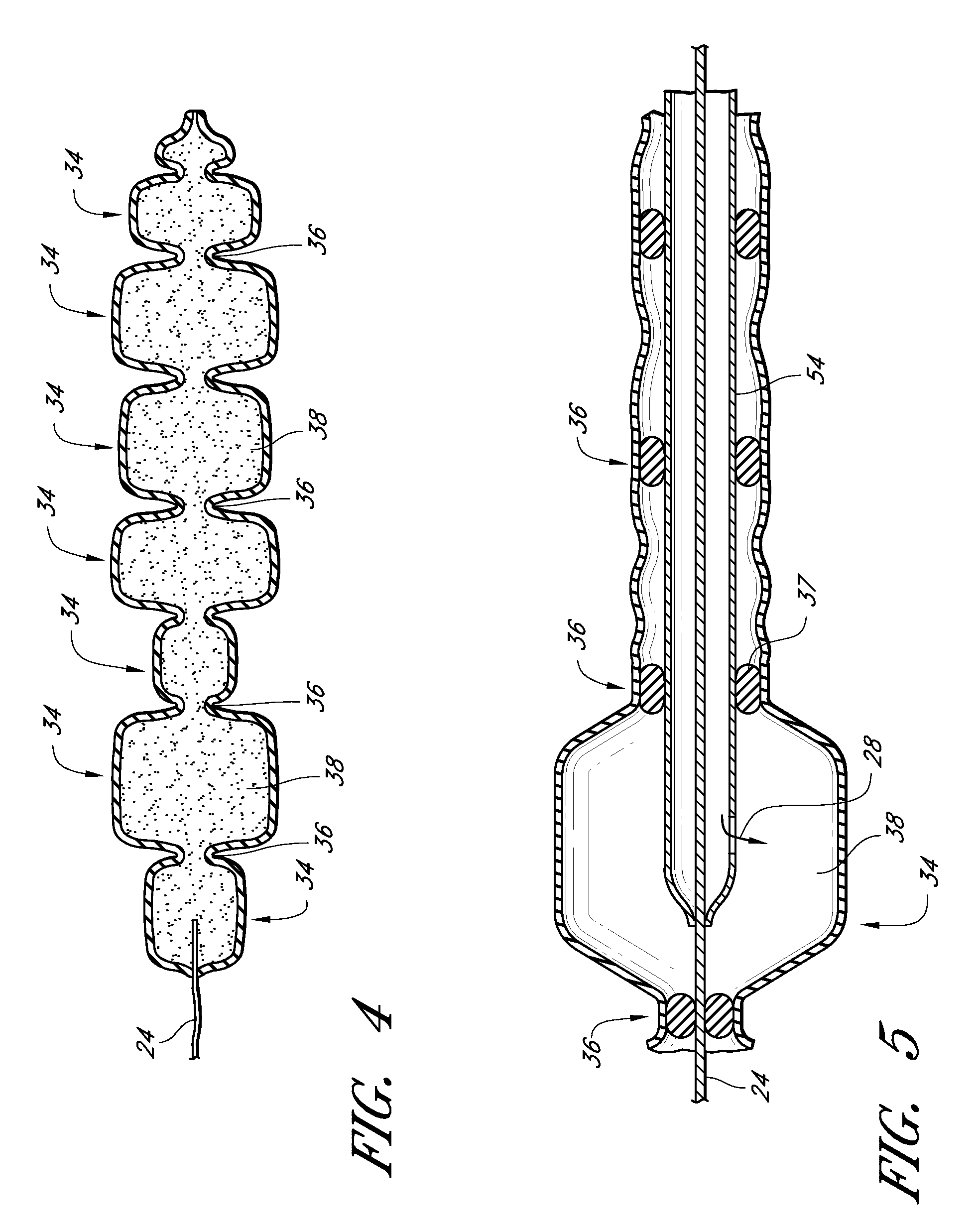 Tissue implant having a biased layer and compliance that simulates tissue