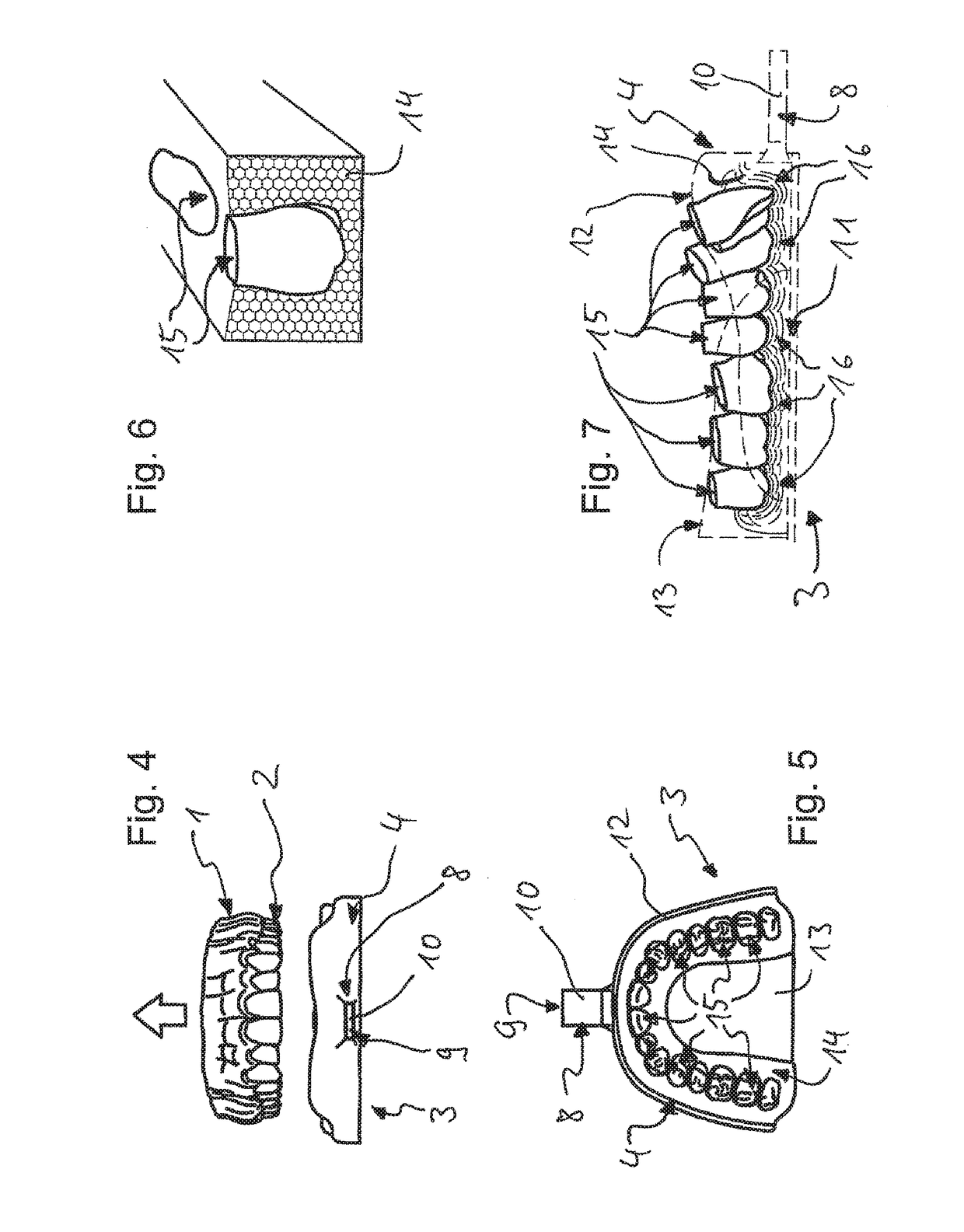 Impression tray, and method for capturing structures, arrangements or shapes, in particular in the mouth or human body