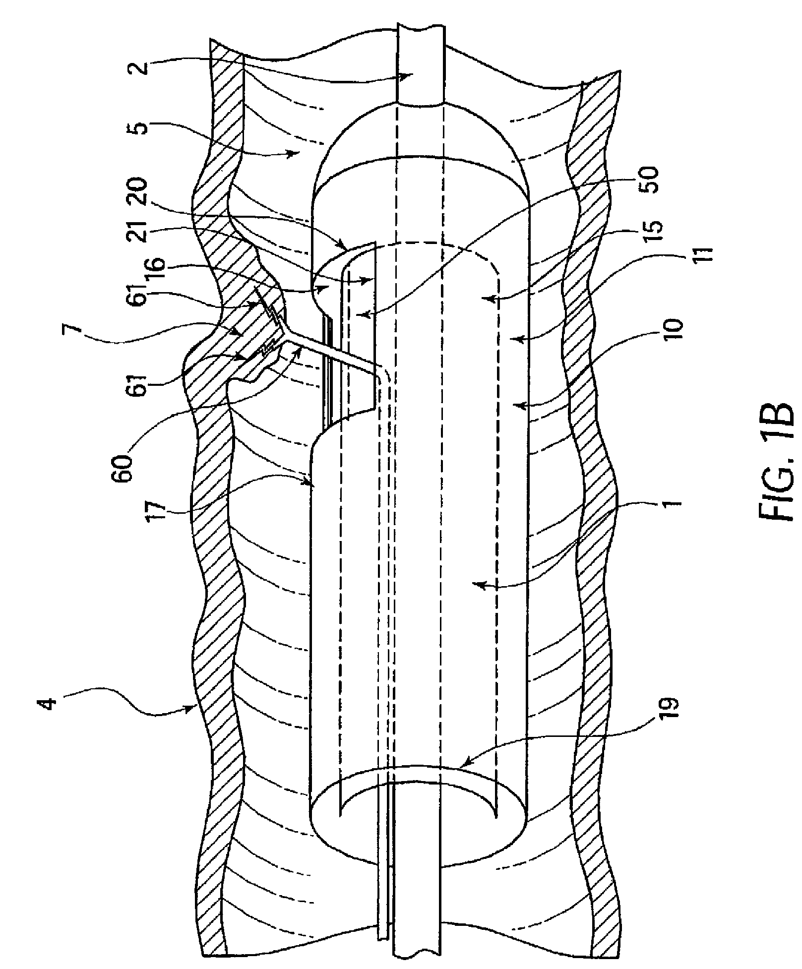 Stapling and cutting in resectioning for full thickness resection devices