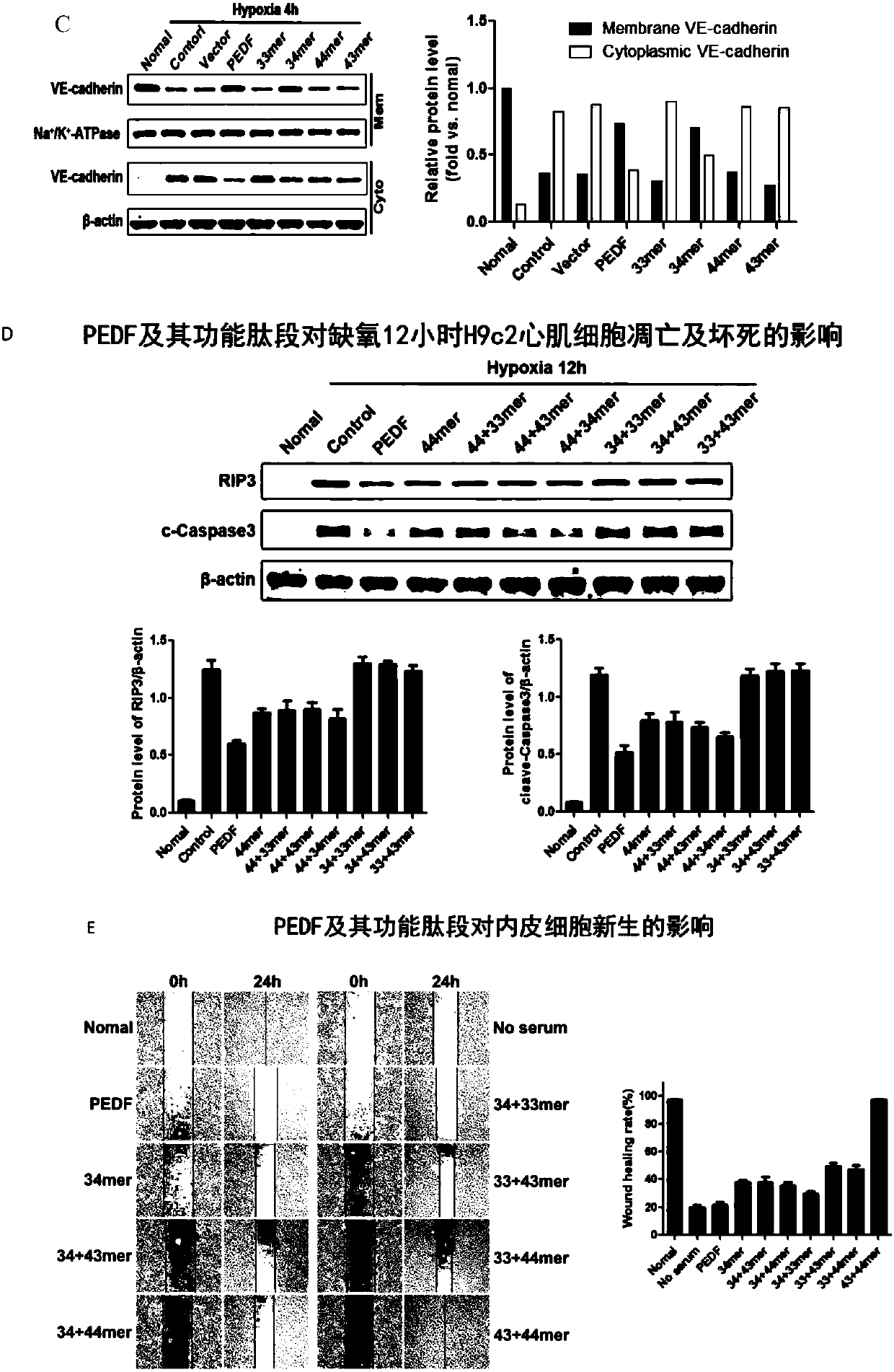 Use of derived polypeptide series of pigment epithelium derived factors in ischemic myocardium protection