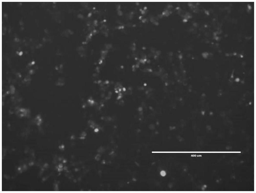 Recombinant adenovirus for expressing African swine fever virus B602L-B646L protein and construction method thereof