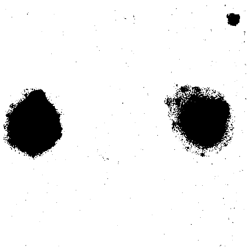 Nano-composite for early diagnosis and treatment of gastric cancer and preparation method of nano-composite