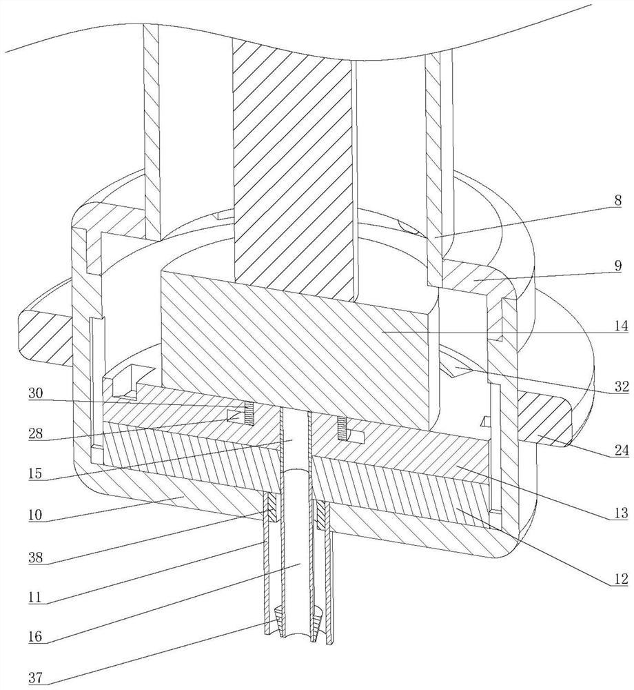 Assistance device for amniocentesis for antenatal diagnosis