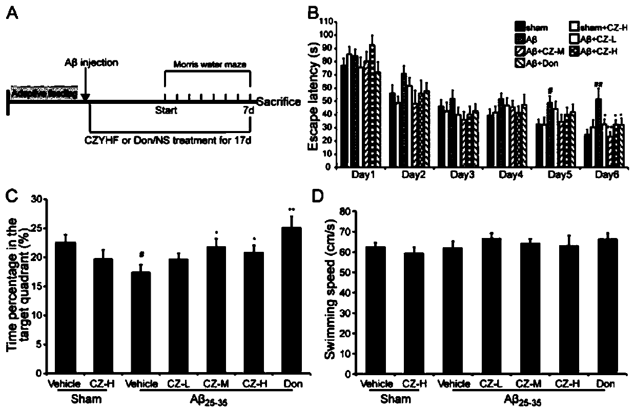 Application of aqueous extract prepared by traditional Chinese medicine prescription in preparing medicine for treating senile dementia