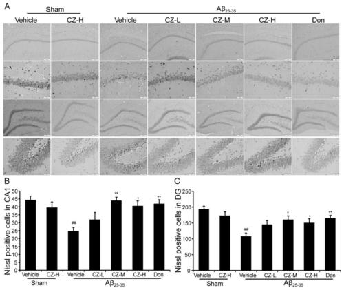 Application of aqueous extract prepared by traditional Chinese medicine prescription in preparing medicine for treating senile dementia