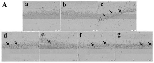 Application of aqueous extract prepared by traditional Chinese medicine prescription in preparing medicine for treating senile dementia