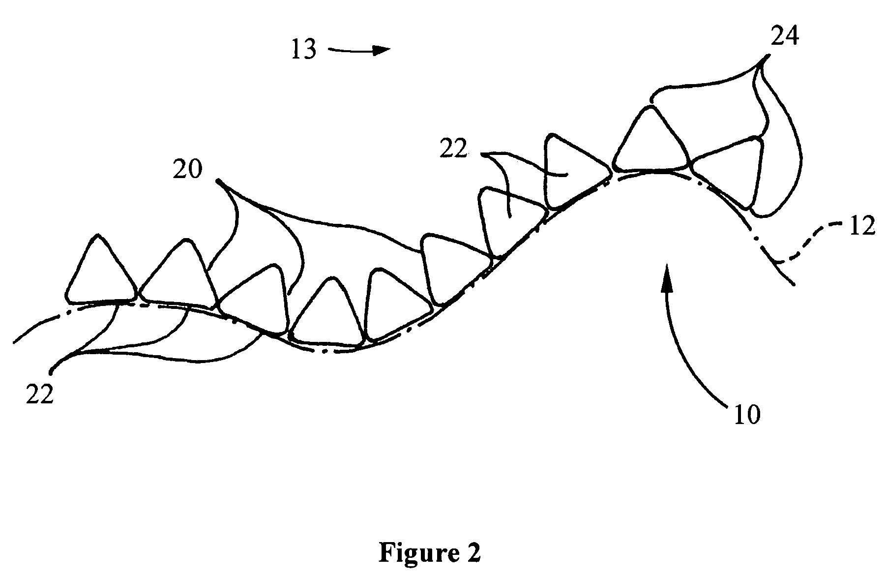 Apparatus and method for creating a floating cover