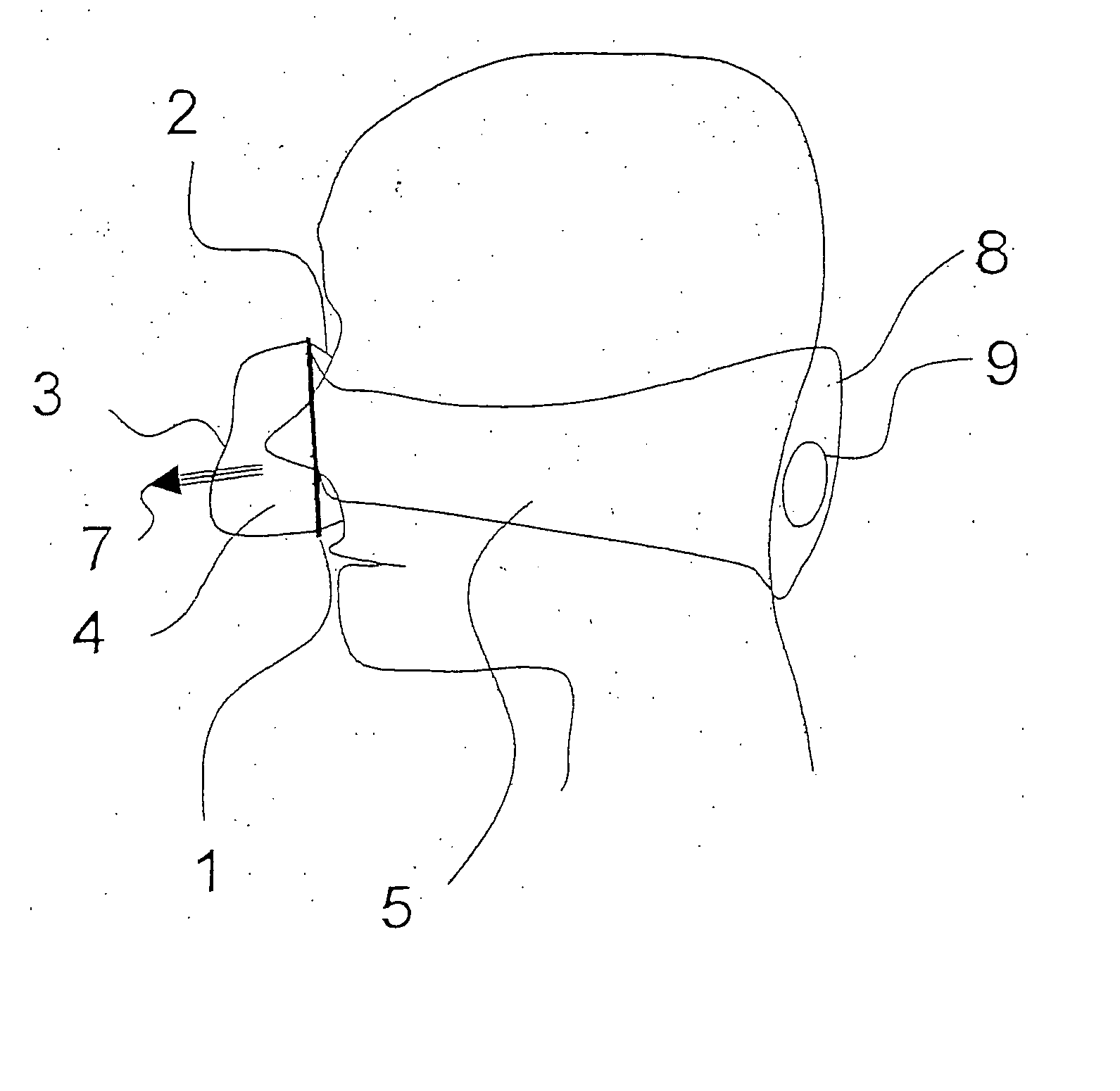 Breathing mask with breathing gas supply through the strap