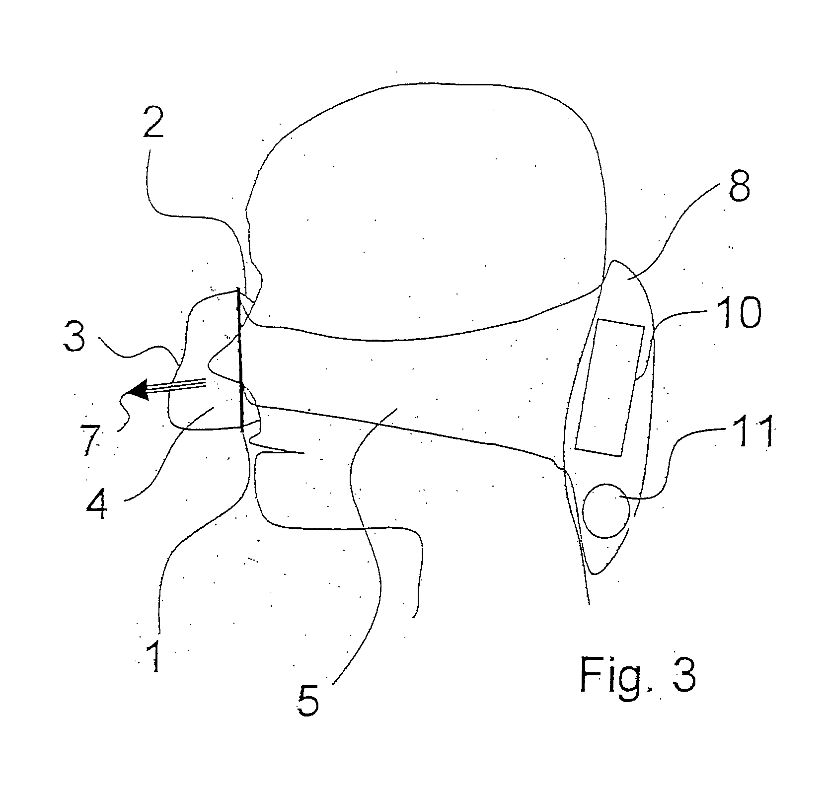 Breathing mask with breathing gas supply through the strap