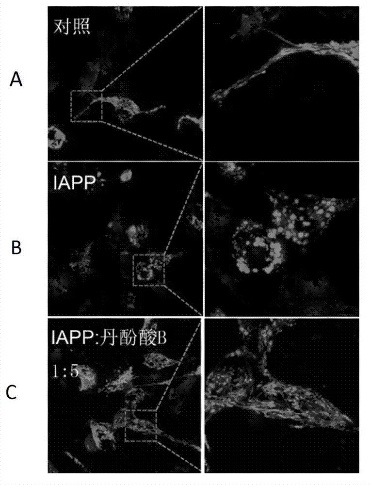 Application of danshinolic acid B in inhibition of islet amyloid polypeptide aggregation and treatment of diabetes