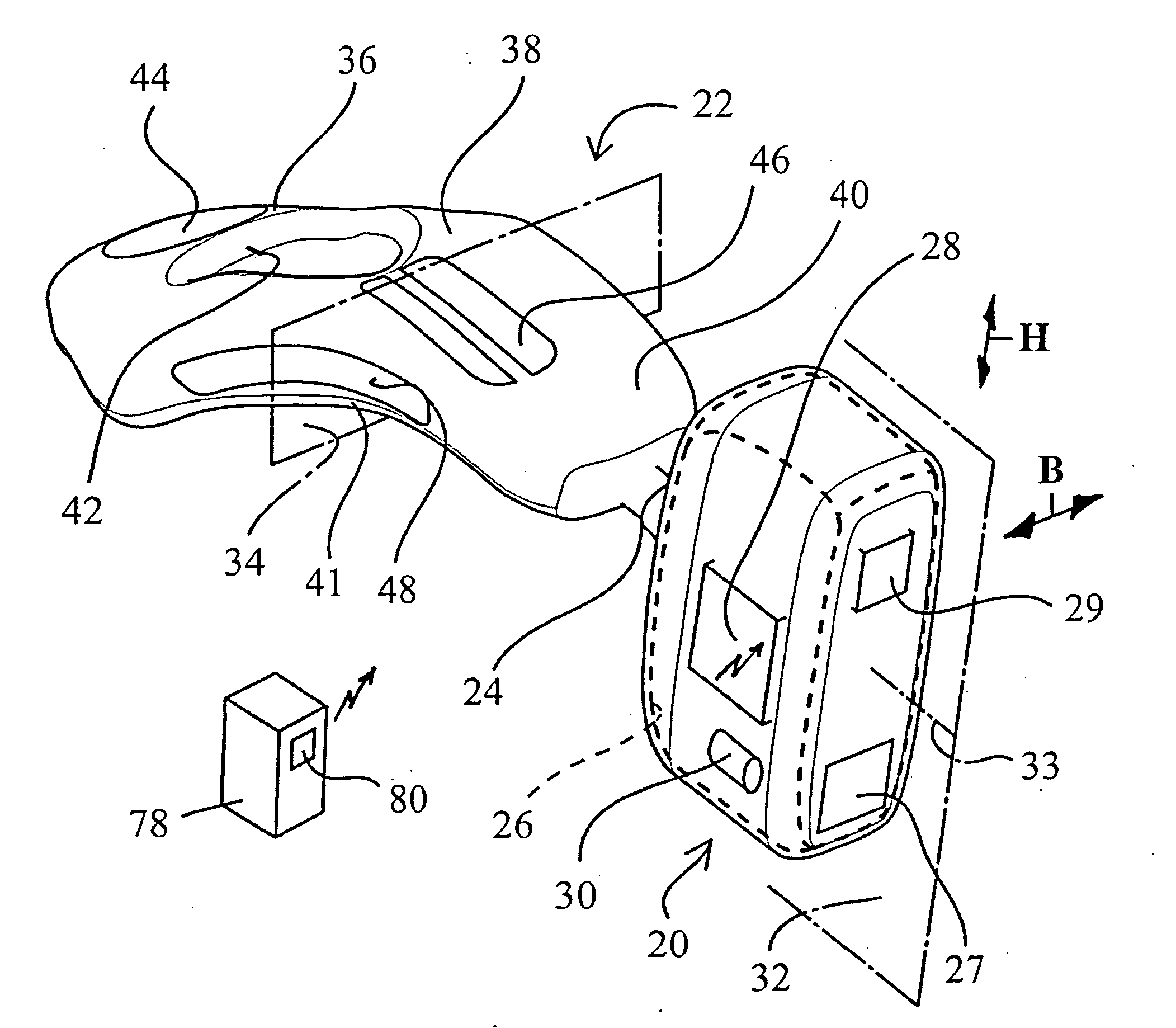 Vaginal probe; in particular for treating incontinence