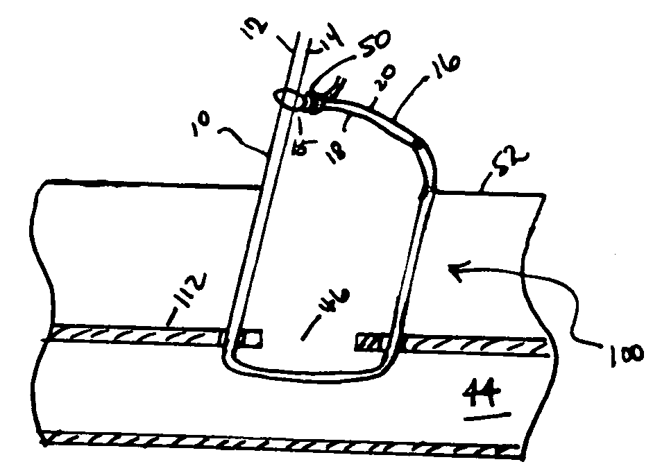 Cinching loop