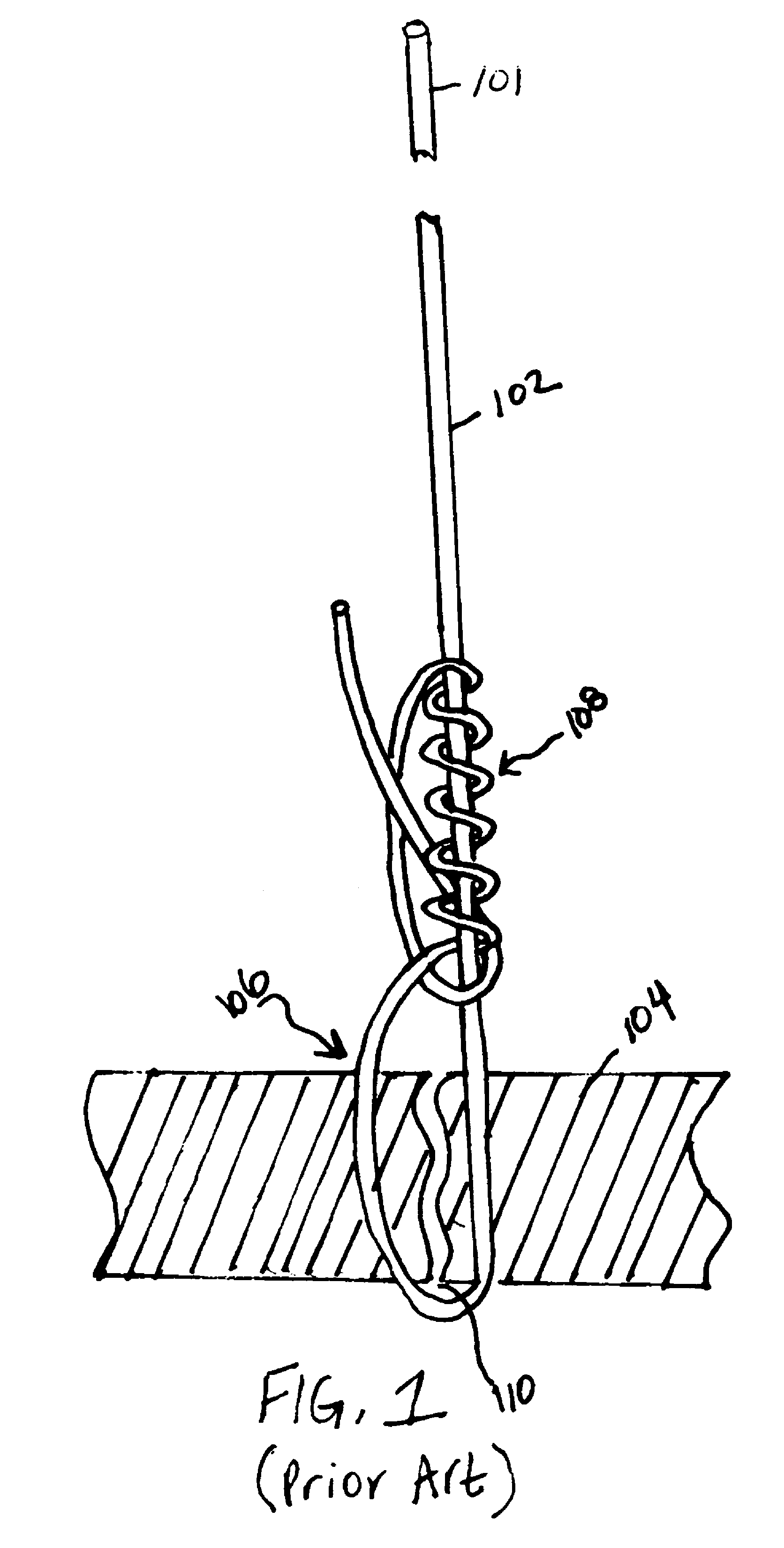 Cinching loop