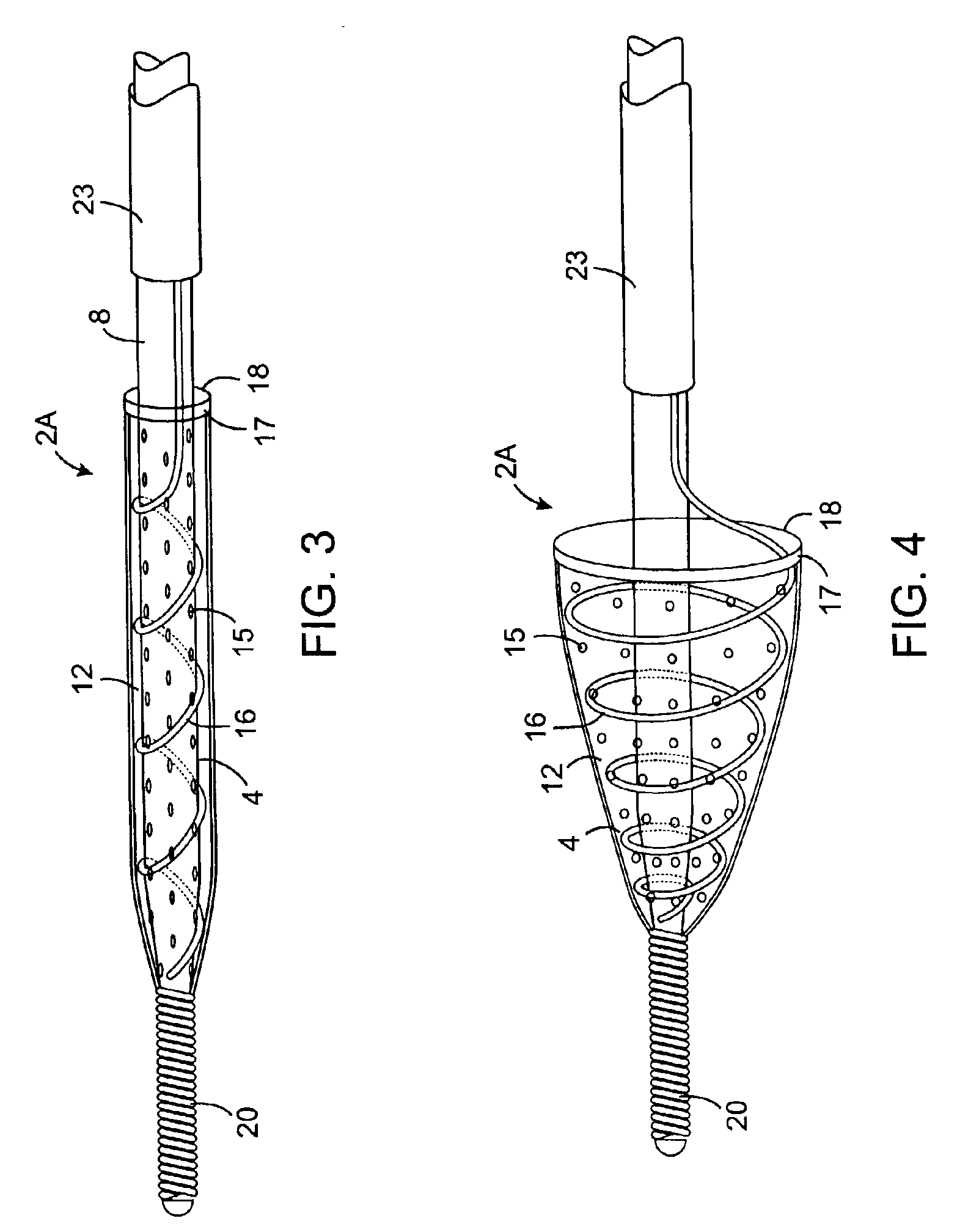 Methods and devices for filtering fluid flow through a body structure