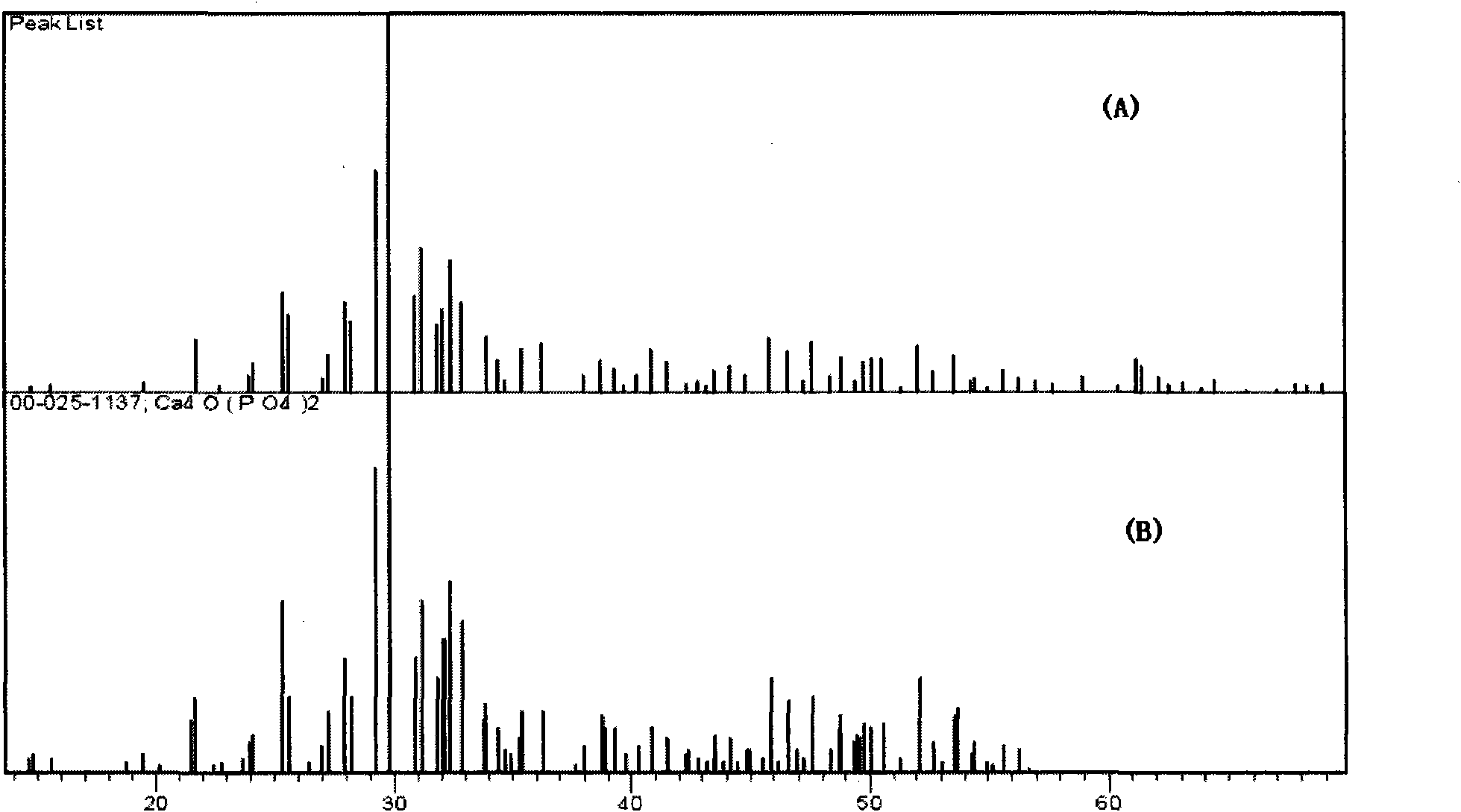 Silk fibroin/calcium phosphate bone cement composite material and preparation method thereof