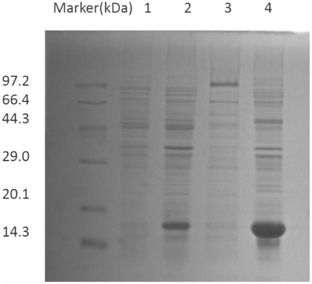 Single-domain antibody resistant to human beta2-microglobulin as well as preparation method and application of single-domain antibody