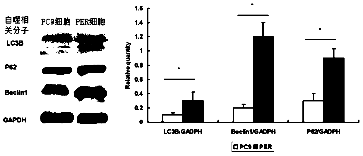 Method and application of autophagy inhibitor for overcoming drug resistance in treatment of lung cancer