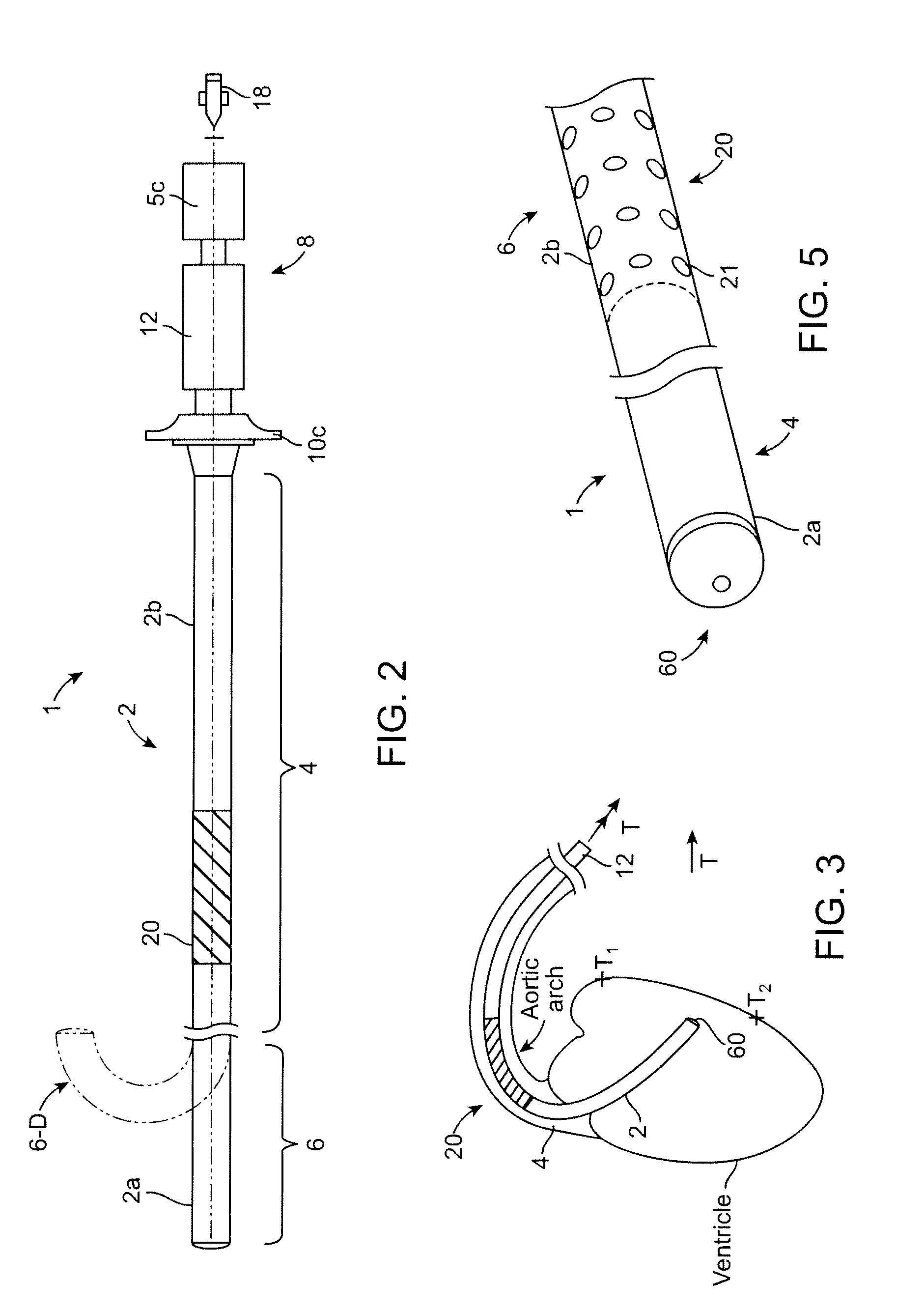 Agent delivery catheters