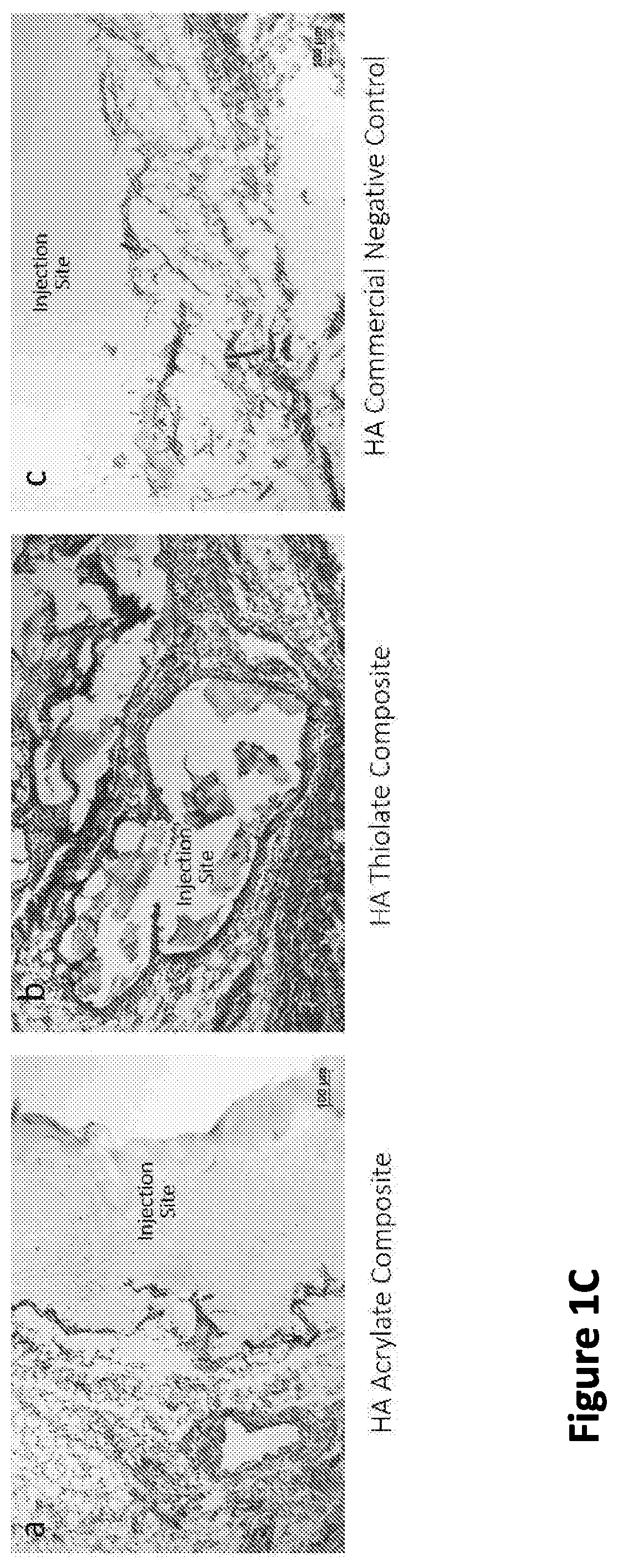 Nanofiber-hydrogel composites for cell and tissue delivery