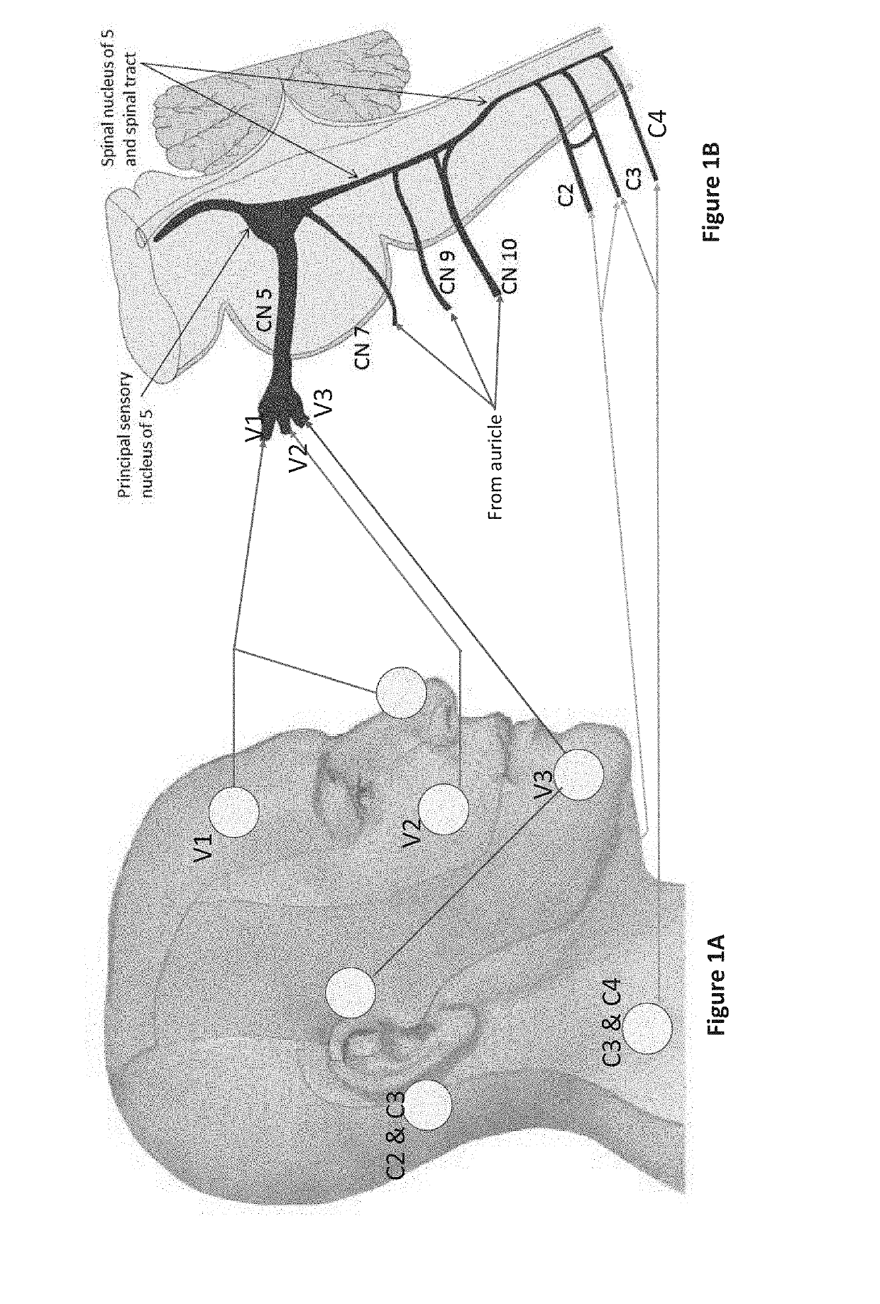 Device, system and method for mechanical cutaneous nerve stimulation for pain, stroke, mood, breathing, movement, sleep, and vascular action