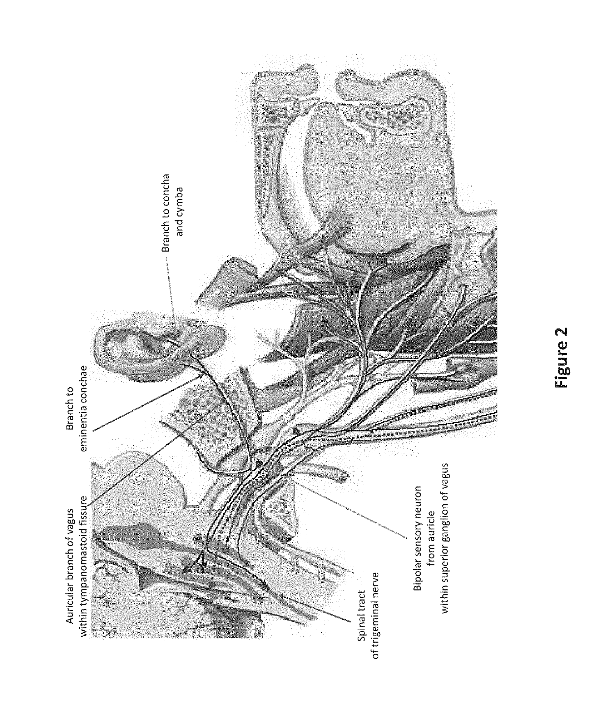 Device, system and method for mechanical cutaneous nerve stimulation for pain, stroke, mood, breathing, movement, sleep, and vascular action