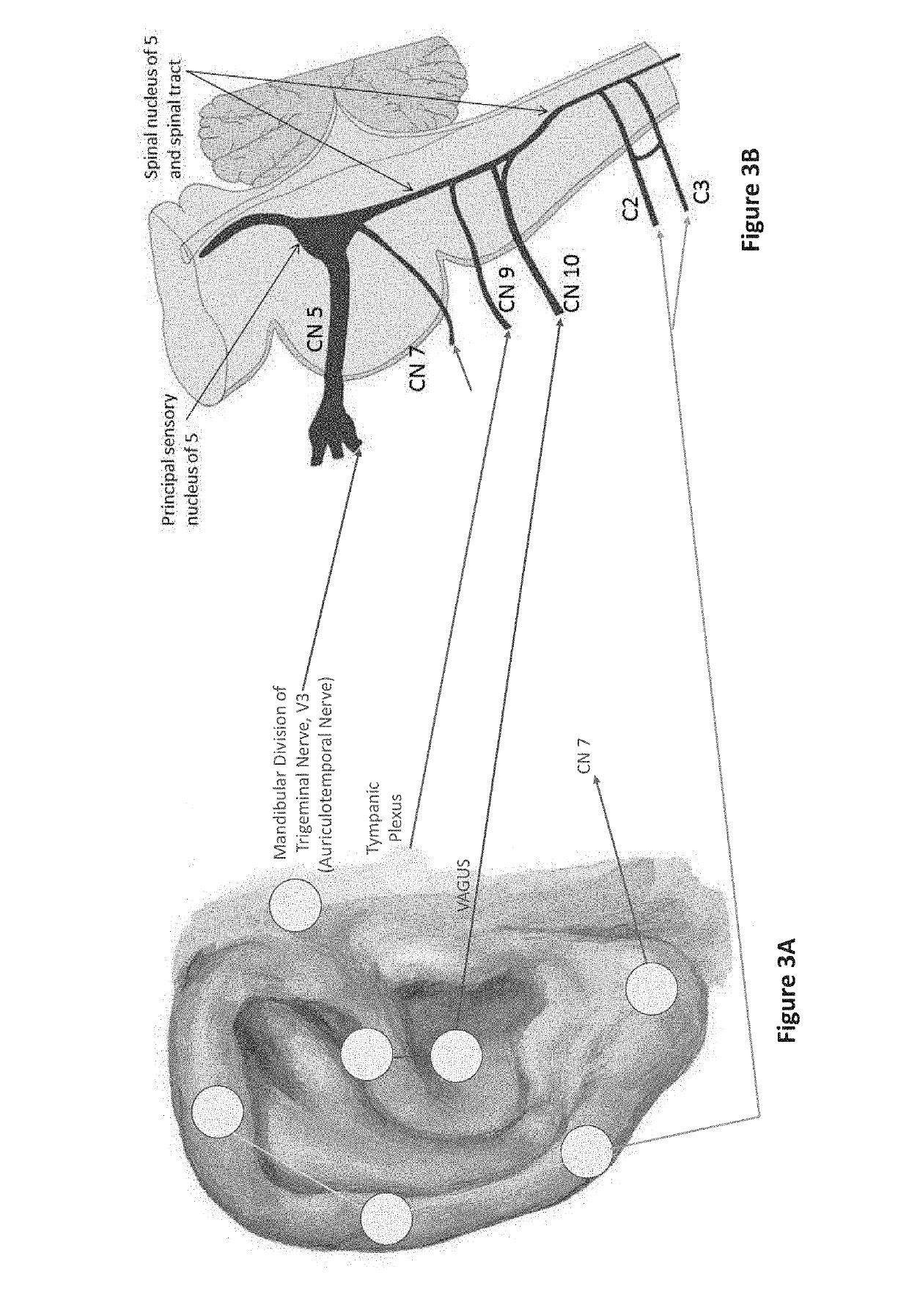 Device, system and method for mechanical cutaneous nerve stimulation for pain, stroke, mood, breathing, movement, sleep, and vascular action