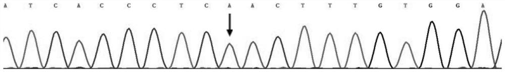 KCNH2 mutant gene and long QT syndrome detection kit