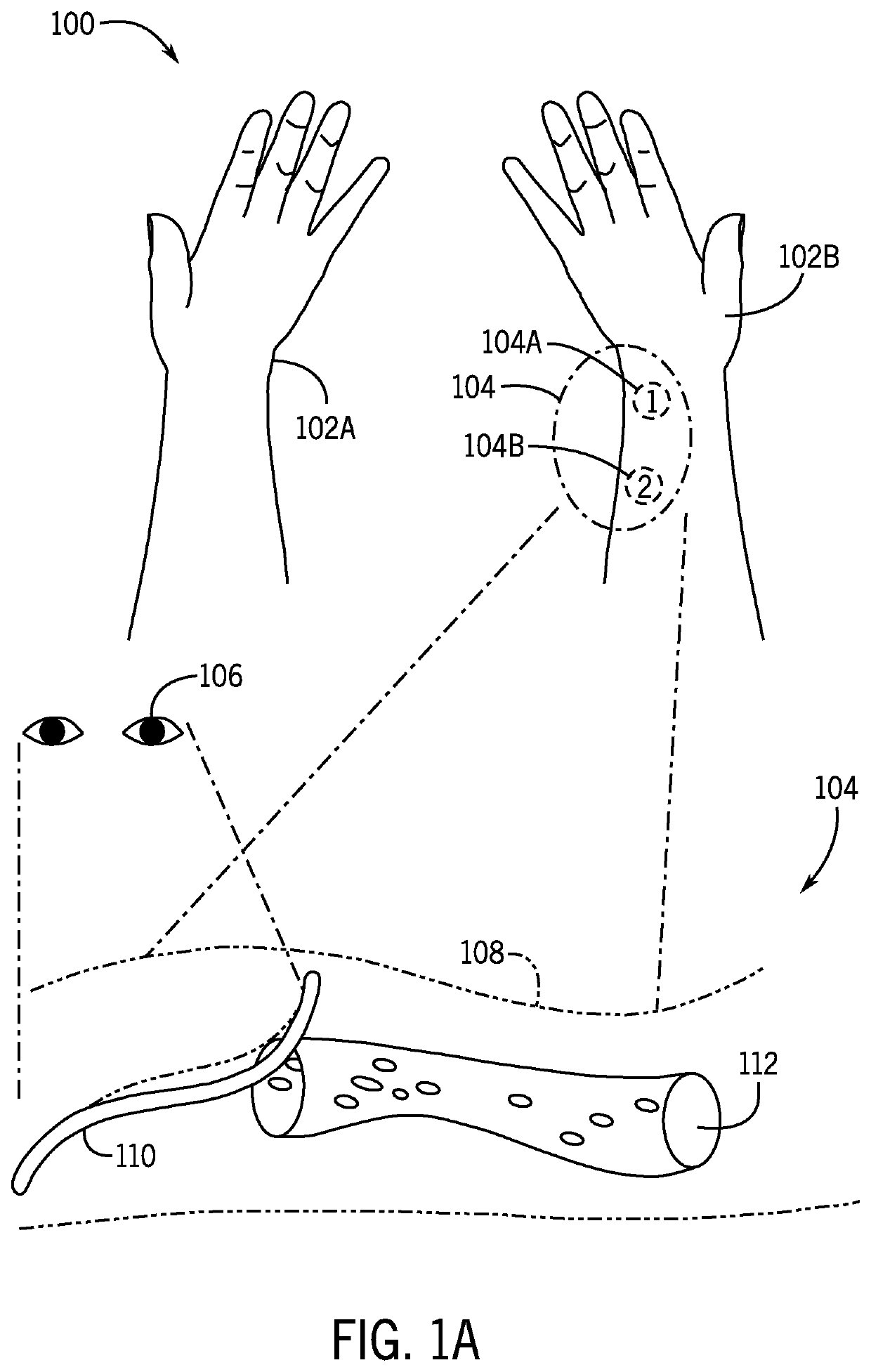 Computer-supported intraneural facilitation for vascular changes