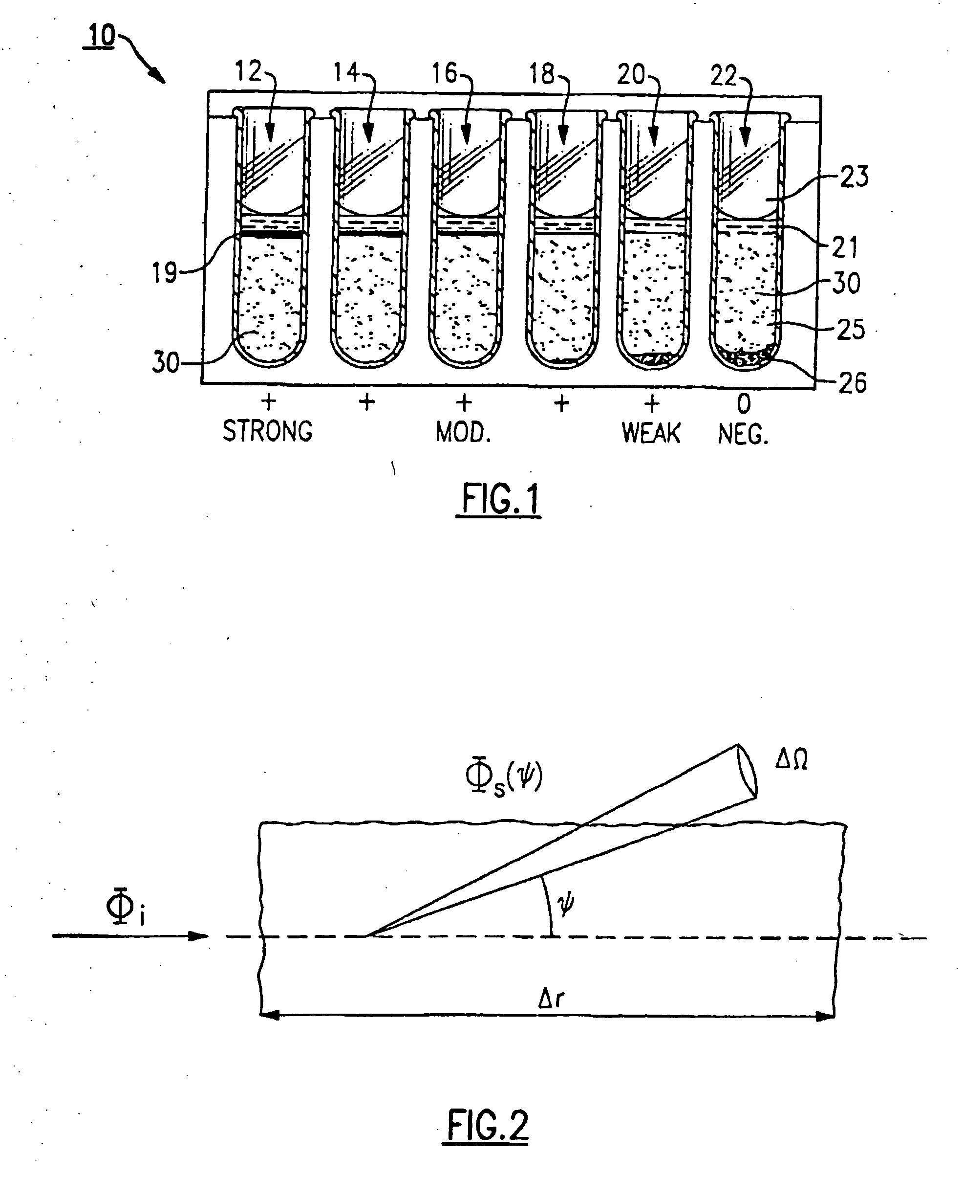 Patient sample classification based upon low angle light scattering