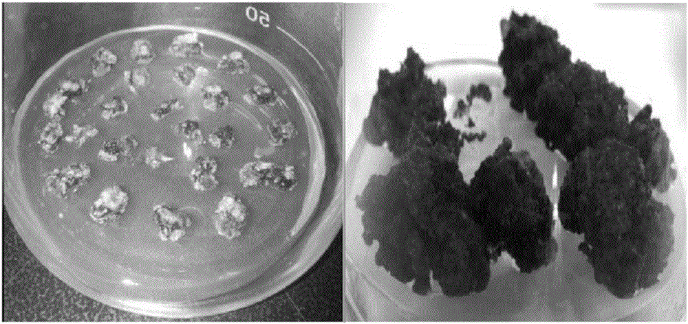 Method and special culture medium for efficiently separating, converting and regenerating potato protoplast