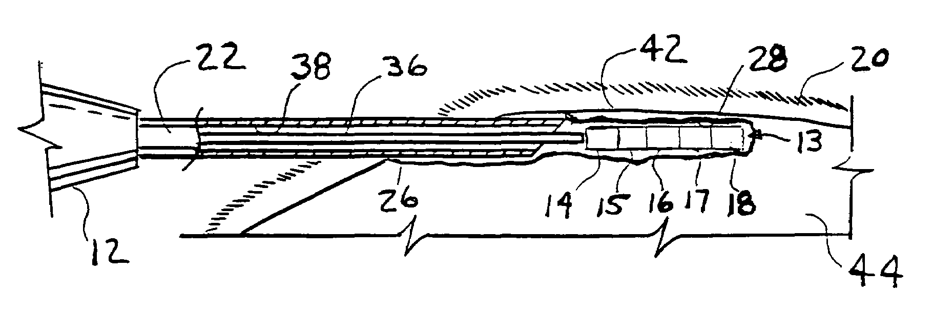 Growth promoting pharmaceutical implant