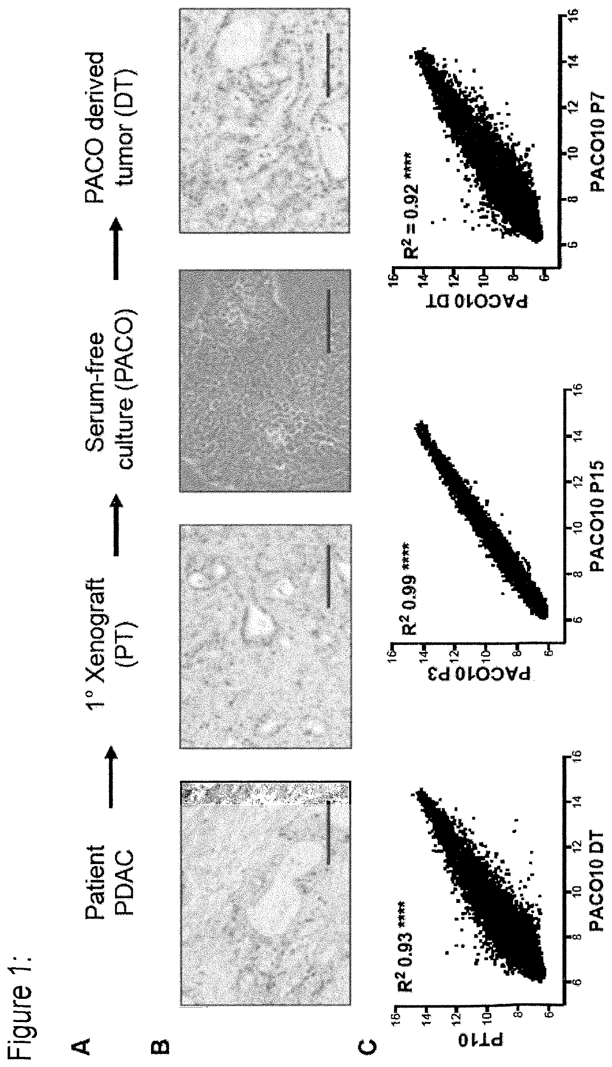 Methods for sub-typing and treating cancer