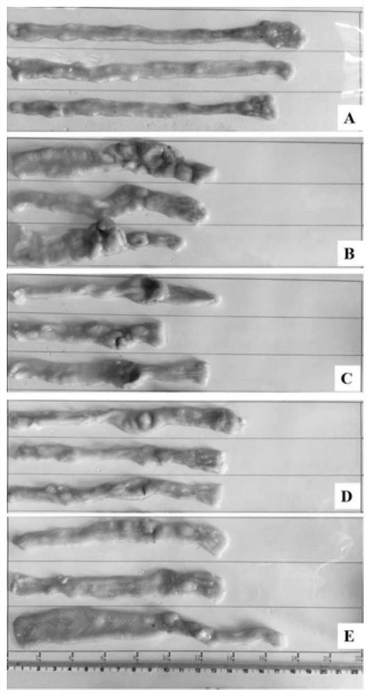 A black medicine composition capable of antagonizing inflammatory bowel disease and its application