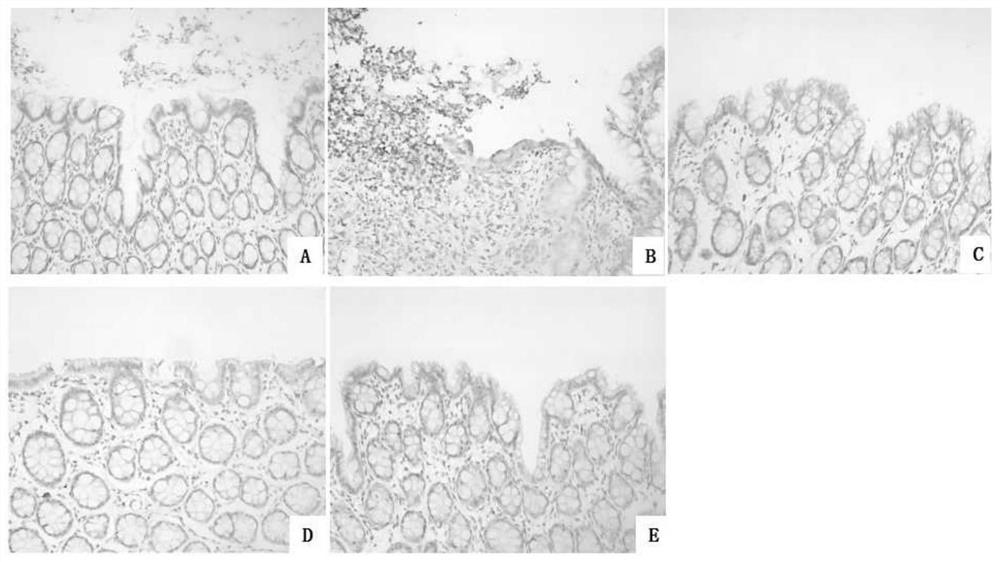 A black medicine composition capable of antagonizing inflammatory bowel disease and its application