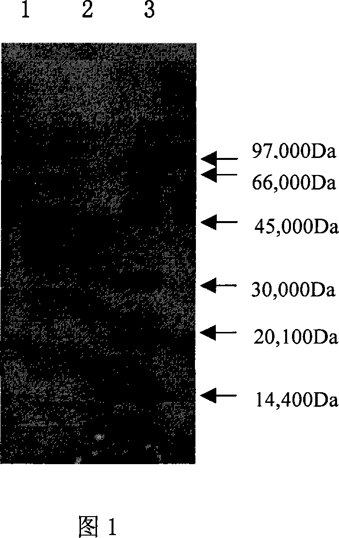 Recombinant human pancreas kininogenase