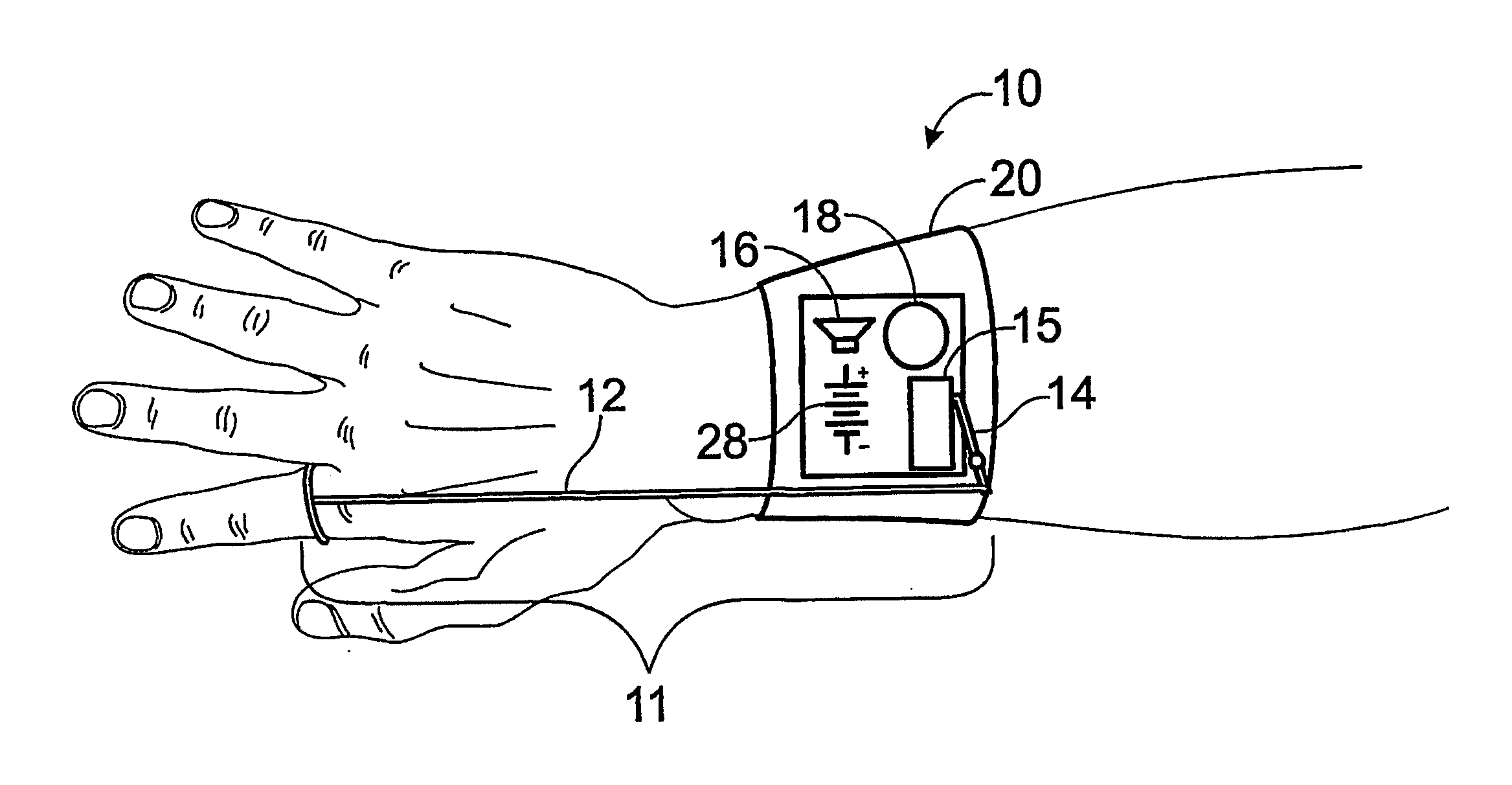 Systems for the prevention or treatment of carpal tunnel syndrome